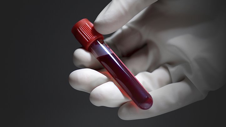 New Blood Test Predicts ‘Late-Phase’ Asthmatic Response
